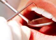 Cheap dentist west Auckland